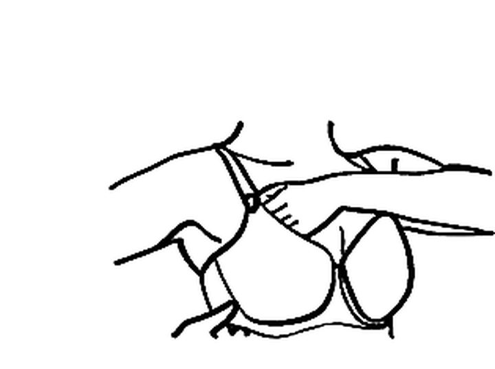 Scoop and swoop technique